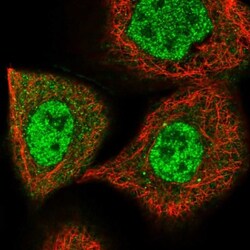 Menin Antibody, Novus Biologicals 25 &mu;L; Unlabeled:Antibodies, Polyclonal